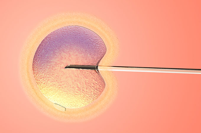 Popular Misconceptions about IVF