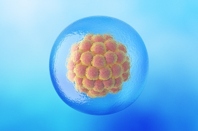 New SGF Study Shows Women with Endometriosis Achieve Equal Success Using Frozen Embryo Transfers