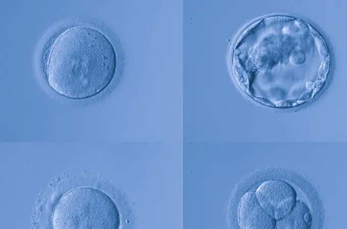 ASRM 2016: SGF Studies Embryo Growth Rate and Likelihood of Chromosomal Abnormality