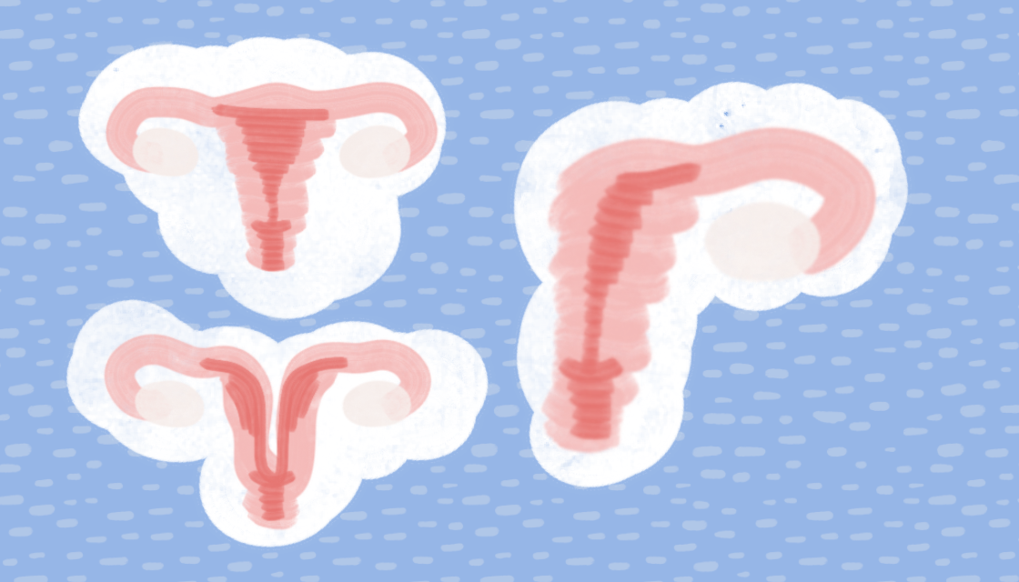 How Uterine Conditions and Anomalies Affect Your Fertility